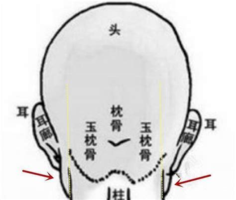 枕骨突出面相|《相学精义》头骨面相注解：耳后无枕骨，智力不足，。